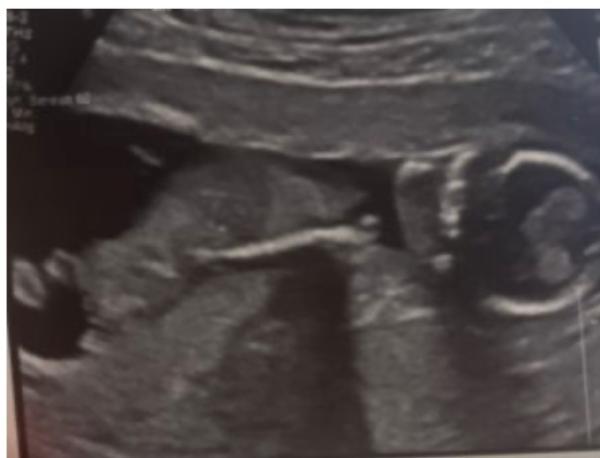 Bild zu Neu hier - Forum für August - Mamis