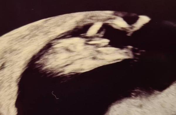 Bild zu US, NIPT und die Geschlechterfrage - Forum für August - Mamis