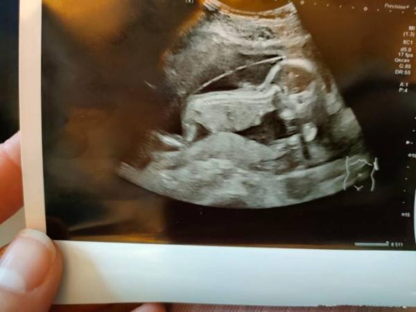 Bild zu Geschlecht? Junge oder Mädchen? - Forum für August - Mamis