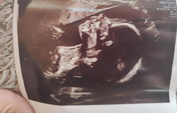 Bild zu 2 großer Ultraschall - Forum für August - Mamis