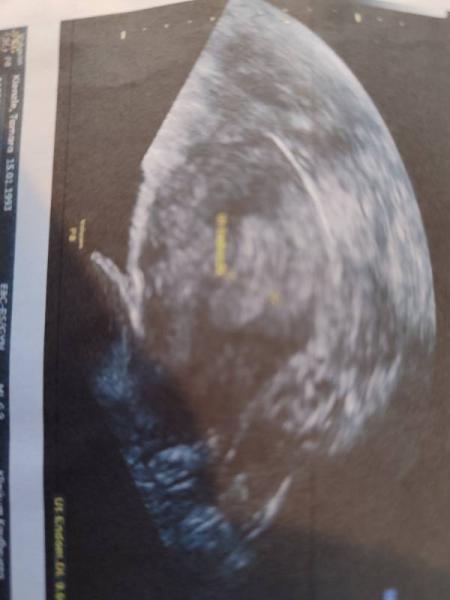 Bild zu Ultraschall Bild - Forum für August - Mamis