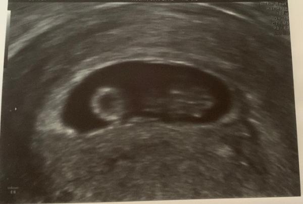 Bild zu Schöne Feiertage und ein frohes Fest - Forum für August - Mamis