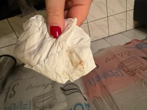 Bild zu Kleine blutung - Forum für August - Mamis