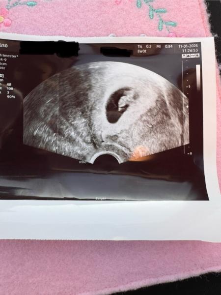 Bild zu 1. Ultraschallbild - Forum für August - Mamis