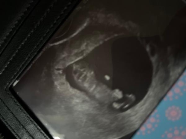 Bild zu 1. Screenig - Forum für August - Mamis