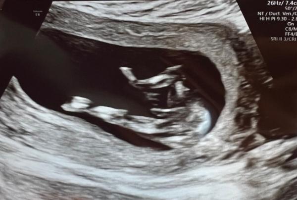 Bild zu Was meint ihr? - Forum für August - Mamis