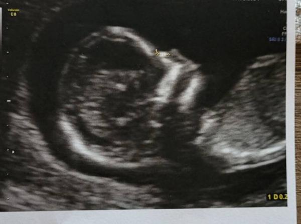 Bild zu Update US - Forum für August - Mamis