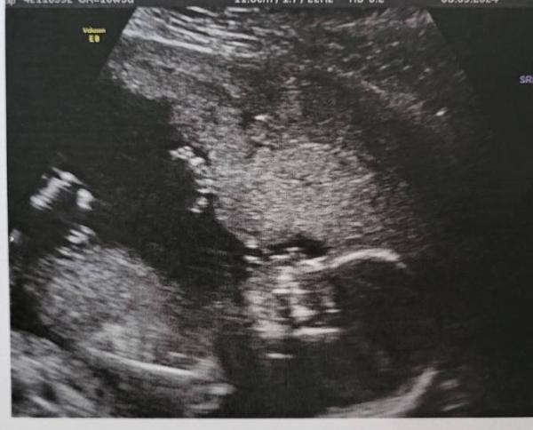 Bild zu US Update - Forum für August - Mamis