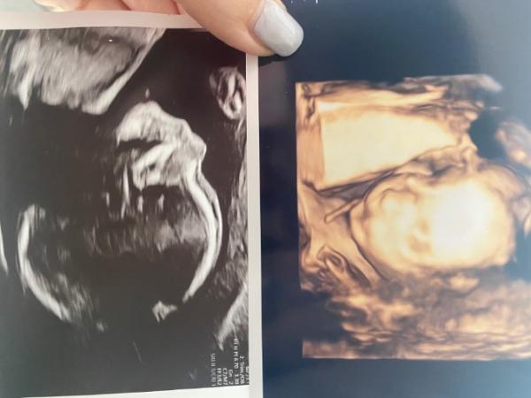 Bild zu Schöne Bilder < 3 - Forum für August - Mamis