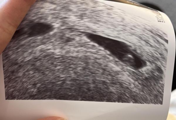 Bild zu Erster Termin - Forum für August - Mamis