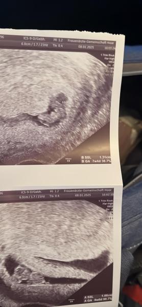 Bild zu Termin gehabt 7 plus 6 - Forum für August - Mamis
