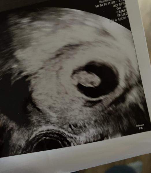 Bild zu 1. Termin und Herzen schlägt - Forum für August - Mamis