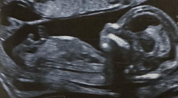 Bild zu Junge oder Mädchen? 14ssw - Forum für August - Mamis