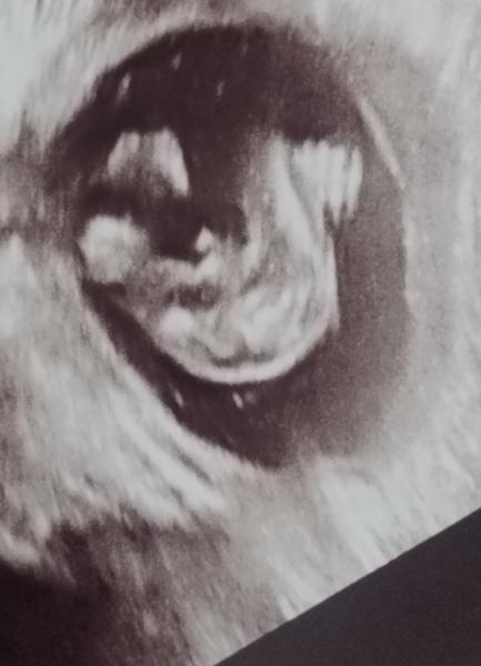 Bild zu Wirklich ein Junge - Forum für August - Mamis