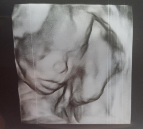 Bild zu Zeigt her eure Ultraschallbilder - Forum für August - Mamis