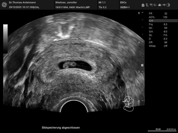 Bild zu Ramzi-Methode Team blau oder rosa - Forum für August - Mamis