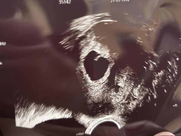 Bild zu Ich steige vorsichtig ein 🎄 Verkündung an Weihnachten? - Forum für August - Mamis