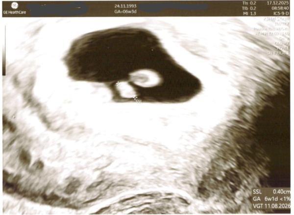 Bild zu 1. FA-Termin 6+1 - Forum für August - Mamis