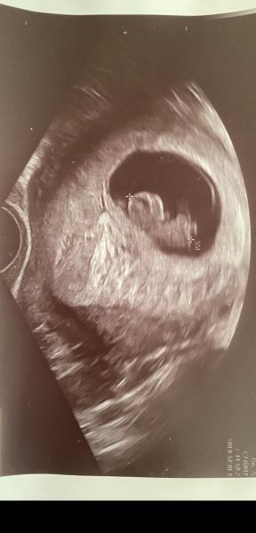 Bild zu 1. Ultraschall geschafft(: - Forum für August - Mamis