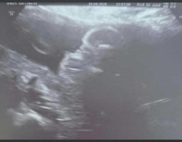 Bild zu Outing Mädchen bei der Feindiagnostik - Forum für August - Mamis