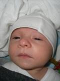 Bild zu Babyakne?? - Forum für September - Mamis