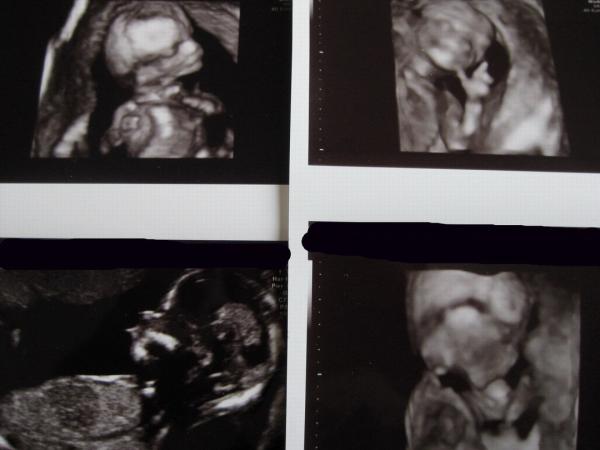 Bild zu Ein Junge in 3-D :o) - Forum für September - Mamis