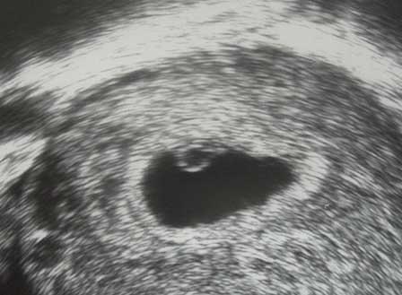 Bild zu Erstes US Bild und FATermin! - Forum für September - Mamis