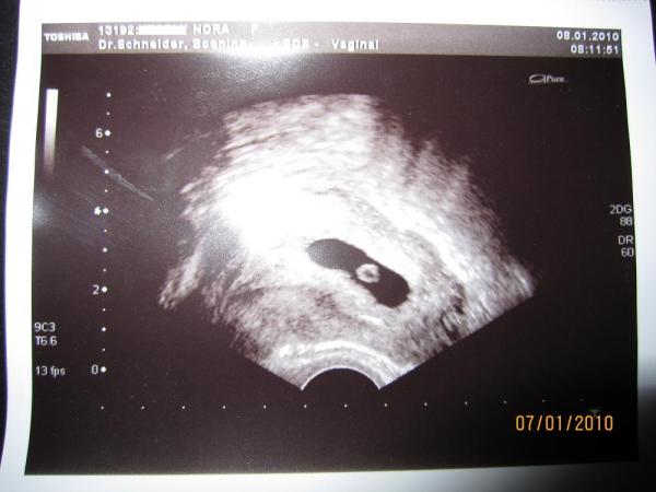 Bild zu Das Herz schlägt... - Forum für September - Mamis
