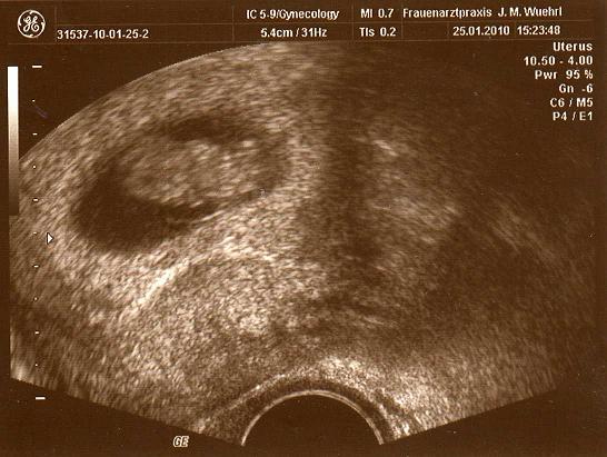 Bild zu war heut fa und hab auch ein us bildchen bekommen - Forum für September - Mamis