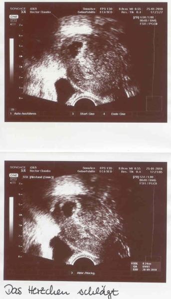 Bild zu US-Bildchen - Forum für September - Mamis