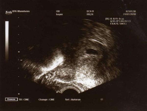 Bild zu bericht und bild - Forum für September - Mamis