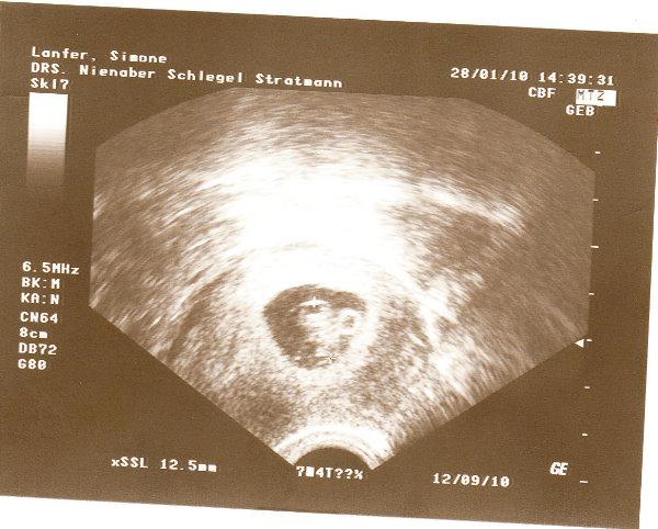 Bild zu Hab auch mein erstes US Bild juhuuuuuu - Forum für September - Mamis