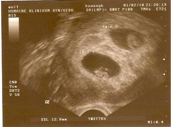 Bild zu hier mal ein Bildchen meiner Würmchen - Forum für September - Mamis