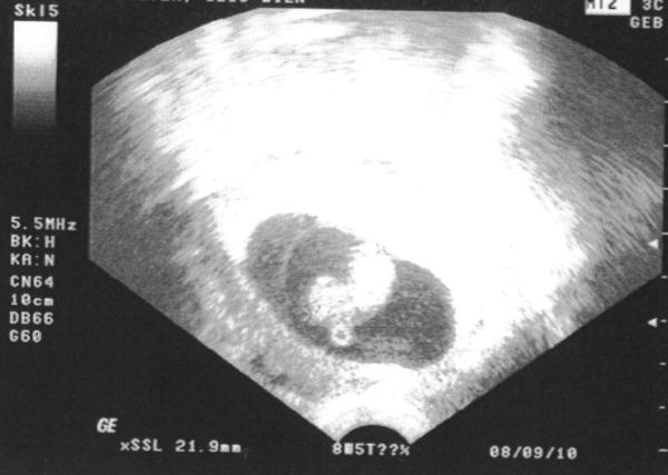 Bild zu auch mal wieder da! + neues Foto extra für september :) - Forum für September - Mamis