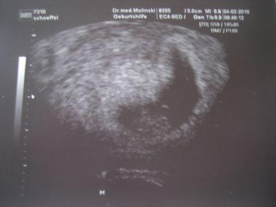Bild zu Bild vom Krümel - Forum für September - Mamis
