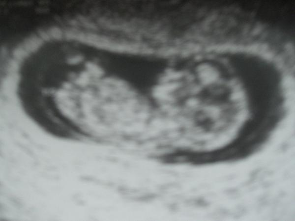 Bild zu Auch Bild vom Bauchkrümel heute!!!!! - Forum für September - Mamis