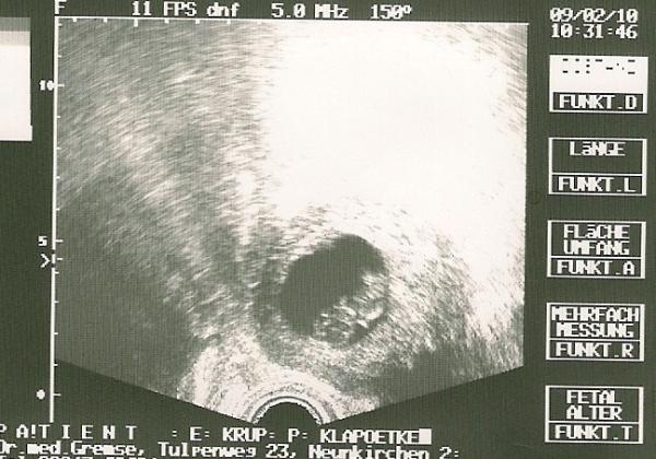 Bild zu Vom FA zurück - Forum für September - Mamis
