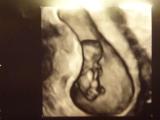 Bild zu heute 4D Ultraschall gehabt... - Forum für September - Mamis