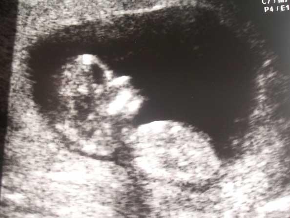 Bild zu Komme auch von der VU zurück :-) - Forum für September - Mamis