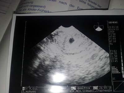 Bild zu Bilder - Forum für September - Mamis