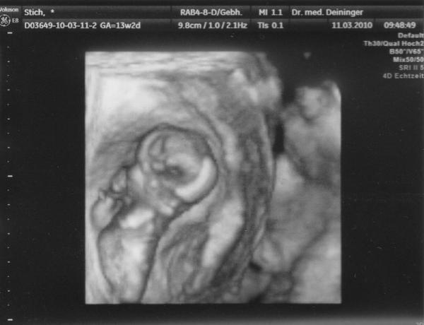 Bild zu Bildchen - Forum für September - Mamis
