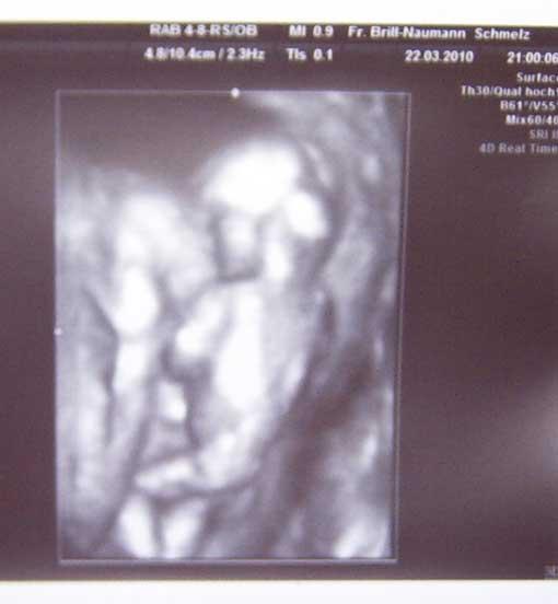 Bild zu Bilder von Gestern :-) - Forum für September - Mamis
