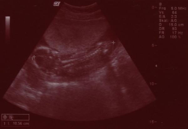 Bild zu Zurück von der VU :D - Forum für September - Mamis