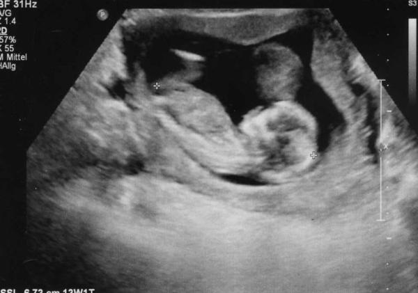 Bild zu US-Foto... darf ich vorstellen... - Forum für September - Mamis