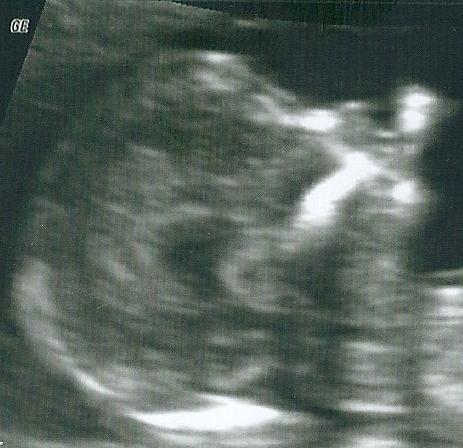 Bild zu US - Forum für September - Mamis