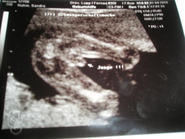 Bild zu so jetzt mal bilder vom FA Thermin :-) - Forum für September - Mamis