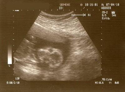 Bild zu heute beim FA - Forum für September - Mamis