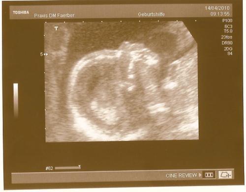 Bild zu Heute VU mit Outing... - Forum für September - Mamis