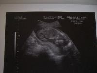 Bild zu VU + Outing - Forum für September - Mamis