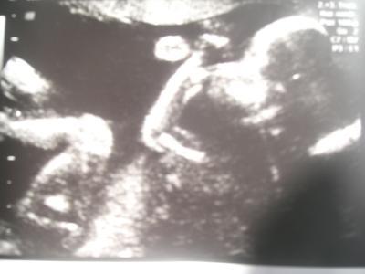 Bild zu Auch zurück vom FA und OrganUS! - Forum für September - Mamis